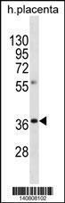 Anti-OR8A1 Rabbit Polyclonal Antibody (AP (Alkaline Phosphatase))