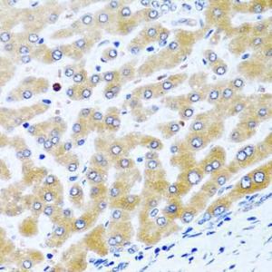 Immunohistochemistry analysis of paraffin-embedded human liver using Anti-CCL21 Antibody (A8977) at a dilution of 1:100 (40X lens)