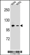 Anti-ITGAM Rabbit Polyclonal Antibody