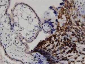 Anti-LIMA1 Mouse Monoclonal Antibody [clone: 1B7]