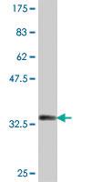 Anti-FBLIM1 Mouse Polyclonal Antibody