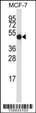 Anti-GDI2 Rabbit Polyclonal Antibody (APC (Allophycocyanin))