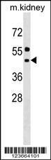 Anti-ALG11 Rabbit Polyclonal Antibody