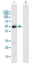 Anti-VDR Mouse Polyclonal Antibody