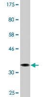 Anti-AMPD2 Mouse Monoclonal Antibody [clone: 6A8]