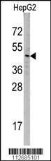 Anti-SNX6 Rabbit Polyclonal Antibody (HRP (Horseradish Peroxidase))