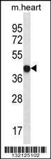 Anti-LPAR6 Rabbit Polyclonal Antibody