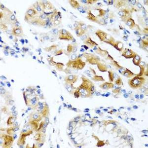 Immunohistochemistry analysis of paraffin-embedded human stomach using Anti-CCL21 Antibody (A8977) at a dilution of 1:100 (40X lens)