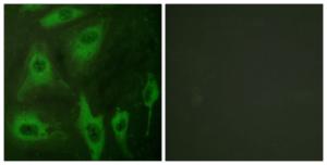 Immunofluorescence analysis of HeLa cells using Anti-Aquaporin 2 Antibody. The right hand panel represents a negative control, where the antibody was pre-incubated with the immunising peptide.