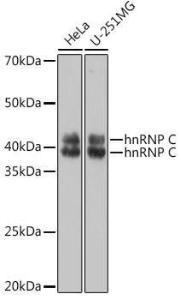 Western blot analysis of extracts of various cell lines, using Anti-hnRNP C1/C2/HNRNPC Antibody (A305310) at 1:1,000 dilution The secondary antibody was Goat Anti-Rabbit IgG H&L Antibody (HRP) at 1:10,000 dilution Lysates/proteins were present at 25 µg per lane