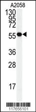 Anti-HSPD1 Rabbit Polyclonal Antibody