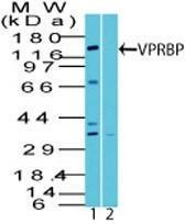 Anti-VPRBP Rabbit Polyclonal Antibody