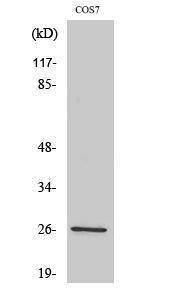 Western blot analysis of various cells using Anti-Aquaporin 2 Antibody