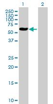 Anti-ALAD Mouse Polyclonal Antibody