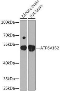 Antibody A93175-100 100 µl