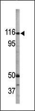 Anti-RBL1 Rabbit Polyclonal Antibody (HRP (Horseradish Peroxidase))