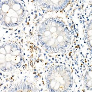 Immunohistochemistry analysis of paraffin-embedded human colon tissue using Anti-TNF alpha Antibody [ARC52538] (A309118) at a dilution of 1:1000(40X lens). Perform high pressure antigen retrieval with 10 mM citrate buffer pH 6.0 before commencing with IHC staining protocol