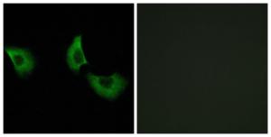 Antibody anti-EFEMP2 100 µg