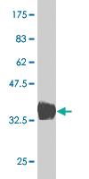 Anti-BARX1 Mouse Monoclonal Antibody [clone: 1E7]