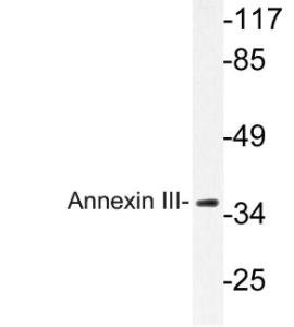 Anti-Annexin A3 Rabbit Polyclonal Antibody