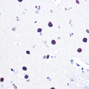 Immunohistochemistry analysis of paraffin-embedded human brain tissue using Anti-hnRNP C1/C2/HNRNPC Antibody (A305310) at a dilution of 1:100 (40x lens) Perform microwave antigen retrieval with 10 mM Tris/EDTA buffer pH 90 before commencing with IHC staining protocol