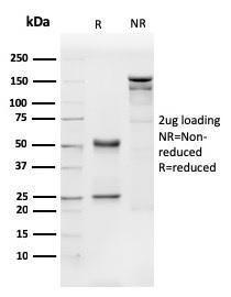 SDS-PAGE analysis of Anti-CD31 Antibody [PECAM1/3540] under non-reduced and reduced conditions; showing intact IgG and intact heavy and light chains, respectively. SDS-PAGE analysis confirms the integrity and purity of the antibody.