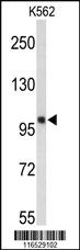 Anti-HSPH1 Rabbit Polyclonal Antibody