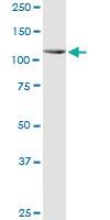 Anti-PPARGC1A Mouse Monoclonal Antibody [clone: 3G11]