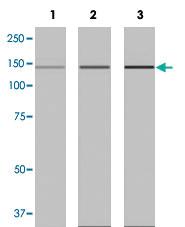 Anti-NPHS1 Rabbit Monoclonal Antibody [clone: Y17-R]