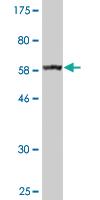 Anti-BDH1 Mouse Monoclonal Antibody [clone: 4B3]