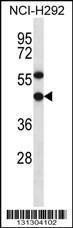 Anti-EBNA1BP2 Rabbit Polyclonal Antibody (PE (Phycoerythrin))