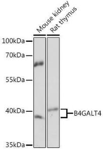 Western blot analysis of extracts of various cell lines, using Anti-B4GALT4 Antibody (A93178) at 1:1,000 dilution The secondary antibody was Goat Anti-Rabbit IgG H&L Antibody (HRP) at 1:10,000 dilution Lysates/proteins were present at 25 µg per lane