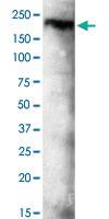 Anti-KDM3B Mouse Monoclonal Antibody