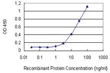 Anti-LIMA1 Mouse Monoclonal Antibody [clone: 1B7]