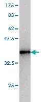 Anti-CETN2 Mouse Monoclonal Antibody [clone: 3F8]