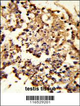 Anti-HSPH1 Rabbit Polyclonal Antibody