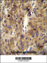 Anti-A1CF Rabbit Polyclonal Antibody