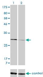 Anti-CAPNS1 Mouse Monoclonal Antibody [clone: 3C4]