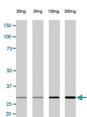 Anti-C1QTNF5 Rabbit Monoclonal Antibody [clone: A14-A]