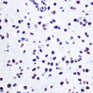 Immunohistochemistry analysis of paraffin-embedded mouse spinal cord using Anti-hnRNP C1/C2/HNRNPC Antibody (A305310) at a dilution of 1:100 (40x lens) Perform microwave antigen retrieval with 10 mM Tris/EDTA buffer pH 90 before commencing with IHC staining protocol