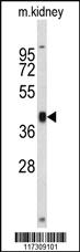 Anti-RFC3 Rabbit Polyclonal Antibody