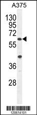 Anti-A1CF Rabbit Polyclonal Antibody