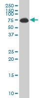 Anti-ALAS1 Mouse Monoclonal Antibody [clone: 3G10]