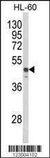 Anti-SNX6 Rabbit Polyclonal Antibody (HRP (Horseradish Peroxidase))