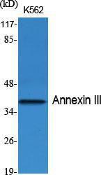 Anti-Annexin A3 Rabbit Polyclonal Antibody