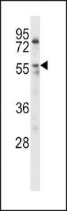 Anti-LPL Rabbit Polyclonal Antibody (APC (Allophycocyanin))