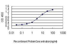 Anti-ALAS1 Mouse Monoclonal Antibody [clone: 3G10]