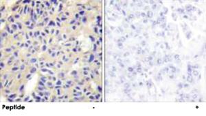 Anti-COL5A2 Rabbit Polyclonal Antibody