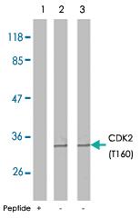 Anti-CDK2 Rabbit Polyclonal Antibody