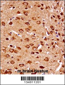 Anti-MAP2K7 Rabbit Polyclonal Antibody (HRP (Horseradish Peroxidase))